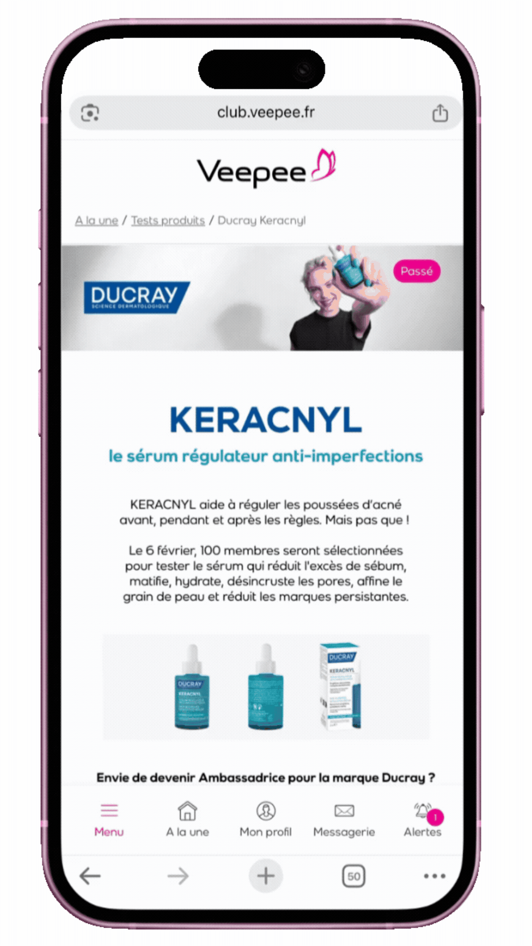 Landing Page dédiée